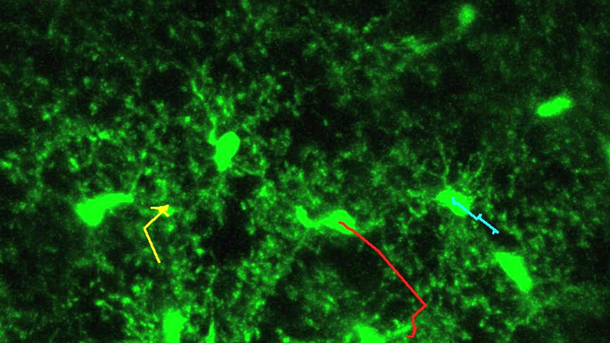 Microglia Translocating Through the Brain Over Three Weeks